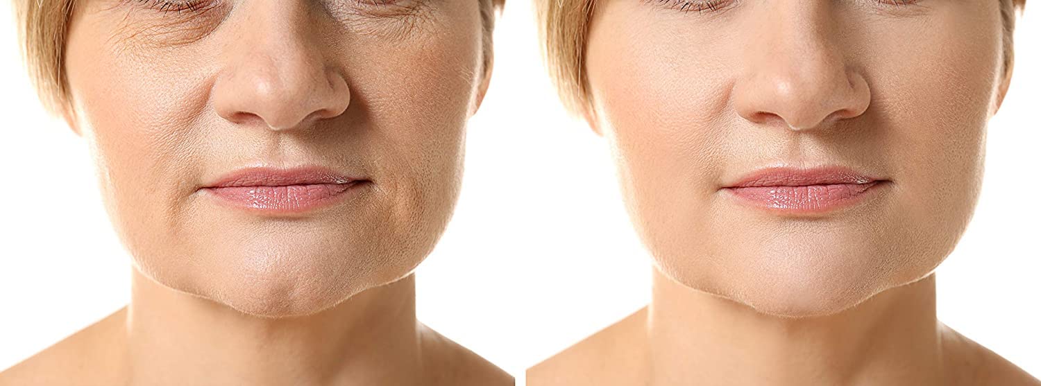 skin repair before and after face brightener