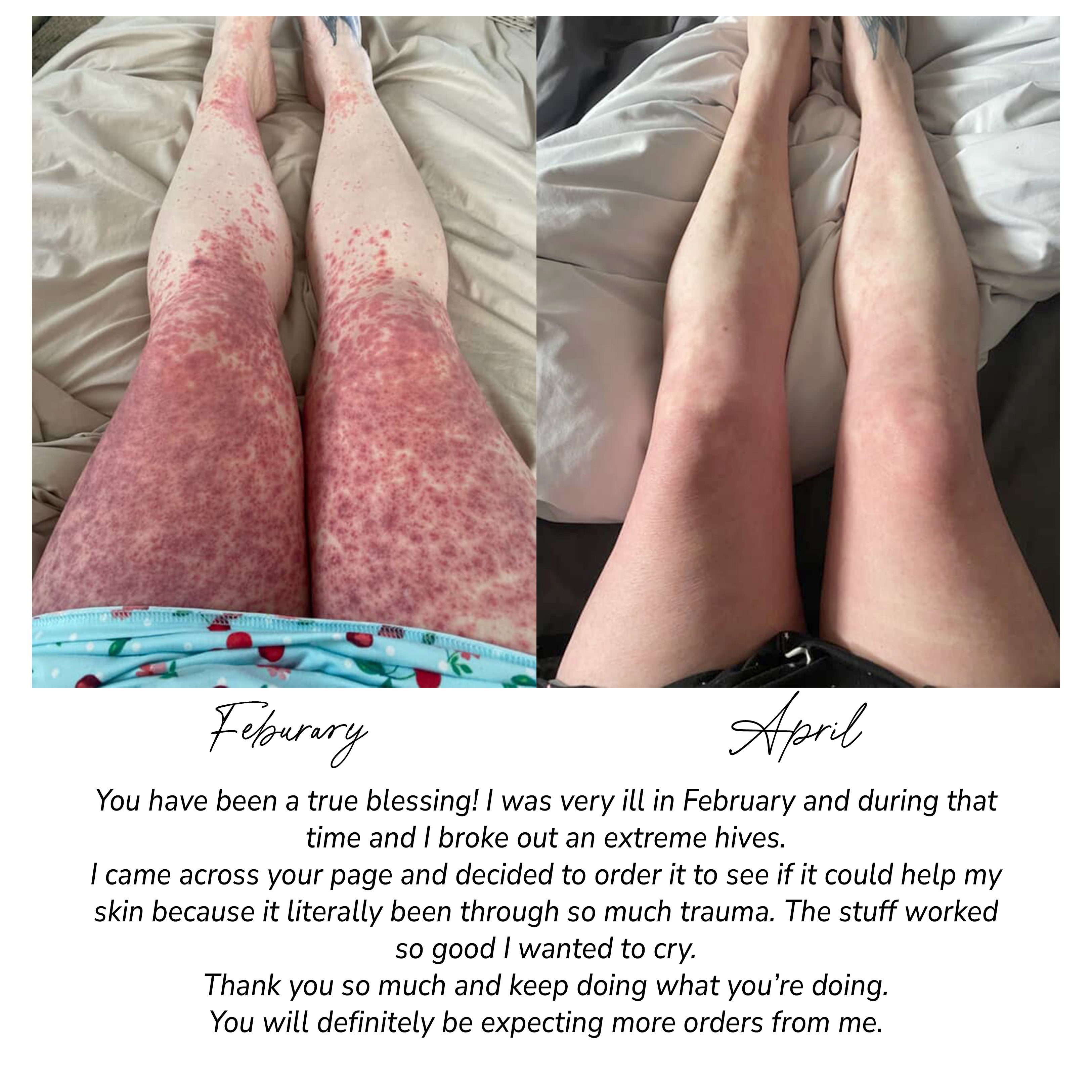 Pretty Farm Girl- Fragrance Free Tallow + Honey Cream for Sensitive Skin