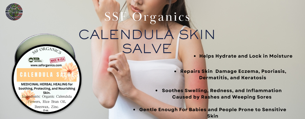Calendula salve oil for skin rashes and eczema psoriasis and dermatitis made with zinc aloe calendula herbal remedy for skin cysts boils bed sores moisturizing dry skin small local company