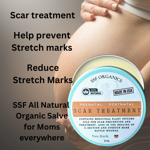 Mama Scar Salve- Treatment for Stretch Marks and C-Section Recovery