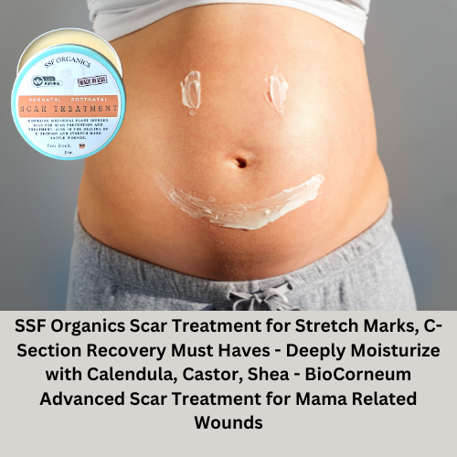 Mama Scar Salve- Treatment for Stretch Marks and C-Section Recovery