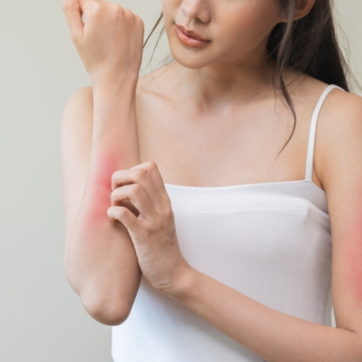 Woman with a red mark on her arm, possibly indicating an allergic reaction or skin issue. Person sitting on a gym floor with exercise equipment around. post surgery workout and joint care. Person meditating with hands in prayer position over sunset at beach. natural healing and topical recovery and relief from arthritis, psoriasis, and eczema. Treats with medicinal herbs like comfrey calendula | arnica | blue tansy | tea tree | bee venom |penetrex and tea for recovery and relief. oras amazing touchy skin fo