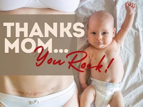 Mama Scar Salve- Treatment for Stretch Marks and C-Section Recovery
