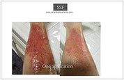 SSF- Drawing Salve Ointment Handmade with Organic Ingredients. Drawing Ointment-Pulls and Dries Cysts, Boils, Stings, Rashes, and Infection.