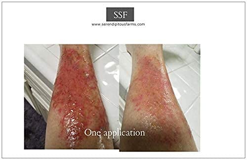 SSF- Drawing Salve Ointment Handmade with Organic Ingredients. Drawing Ointment-Pulls and Dries Cysts, Boils, Stings, Rashes, and Infection.