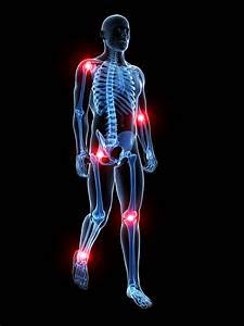 Sore Joints - Sore Muscles - Joint Relief Organic Comfrey Salve - Organic Comfrey  or bone healing and skin muscle and arthritis relief Organic Comfrey Salve - Organic Comfrey  or bone healing and skin muscle and arthritis relief comfrey salve | Penetrex | Joint Pain | Arthritis | Eczema | Psoriasis | Cyst | Infection | antifungal | Sore | Rash | Bite | Sting | Bee Venom |
